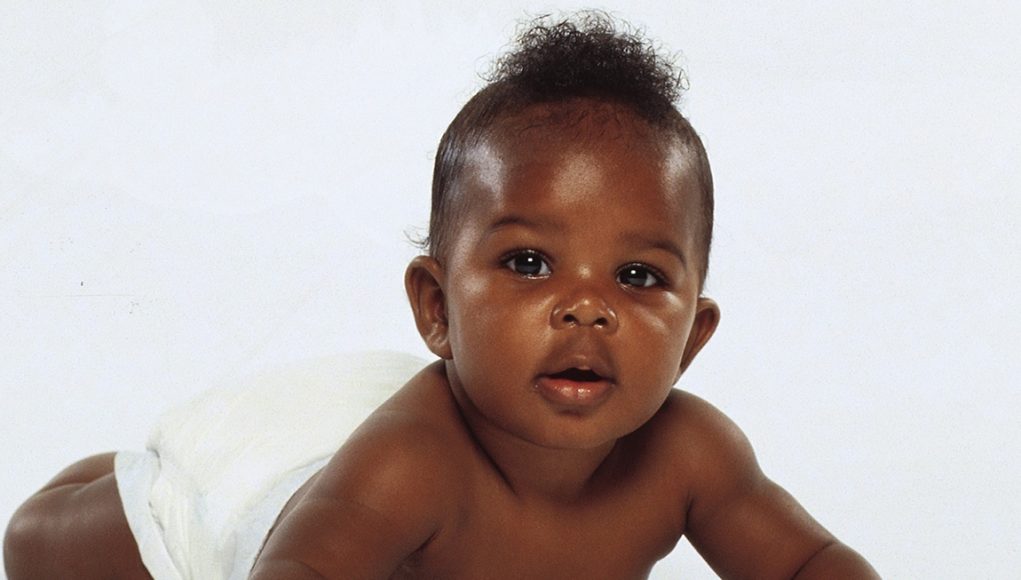 Baby dick. Лихорадка чернокожий у детей рисунок. Фотография Cherona Baby. Младенец черный волосатый.